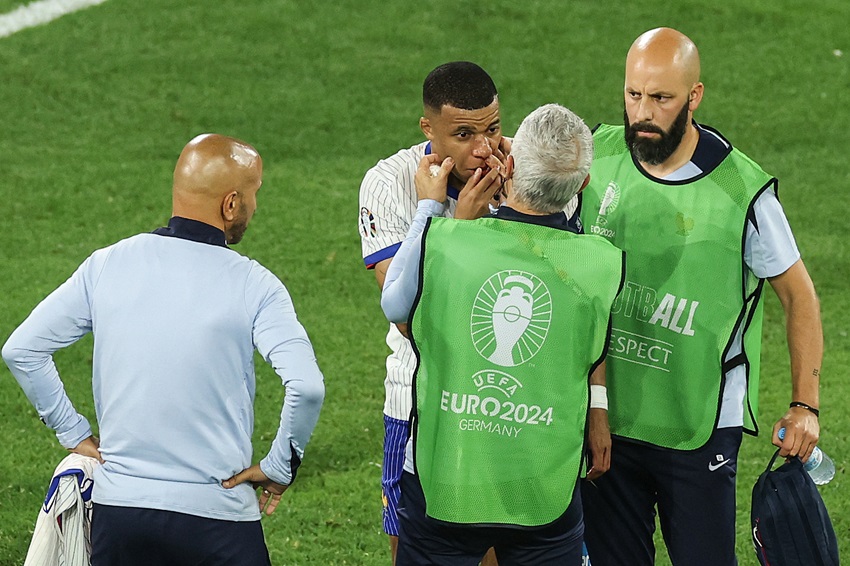Kylian Mbappé no necesitará operación en la nariz, confirma el presidente de la federación francesa